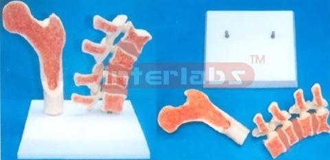 MIDDLE VERTEBRA AND MORBIDITY FEMUR BONE DEMONSTRATION MODEL